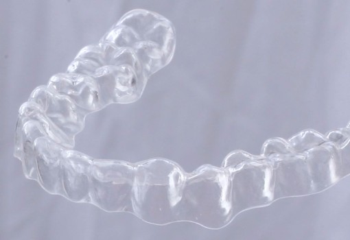 Clearliners Clear Orthodontic Aligners, Courtenay Dentist